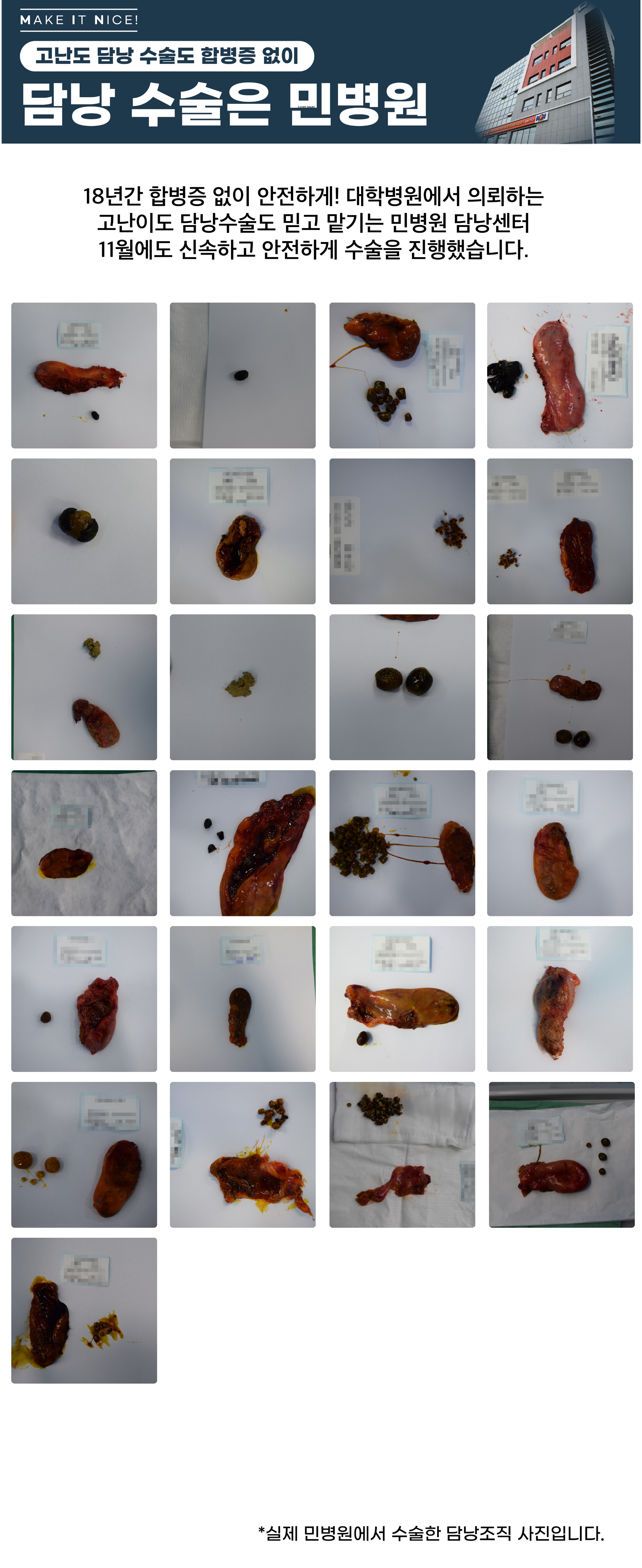 [담낭수술사례] 민병원 11월 담낭수술 후 제거된 조직 사진입니다...