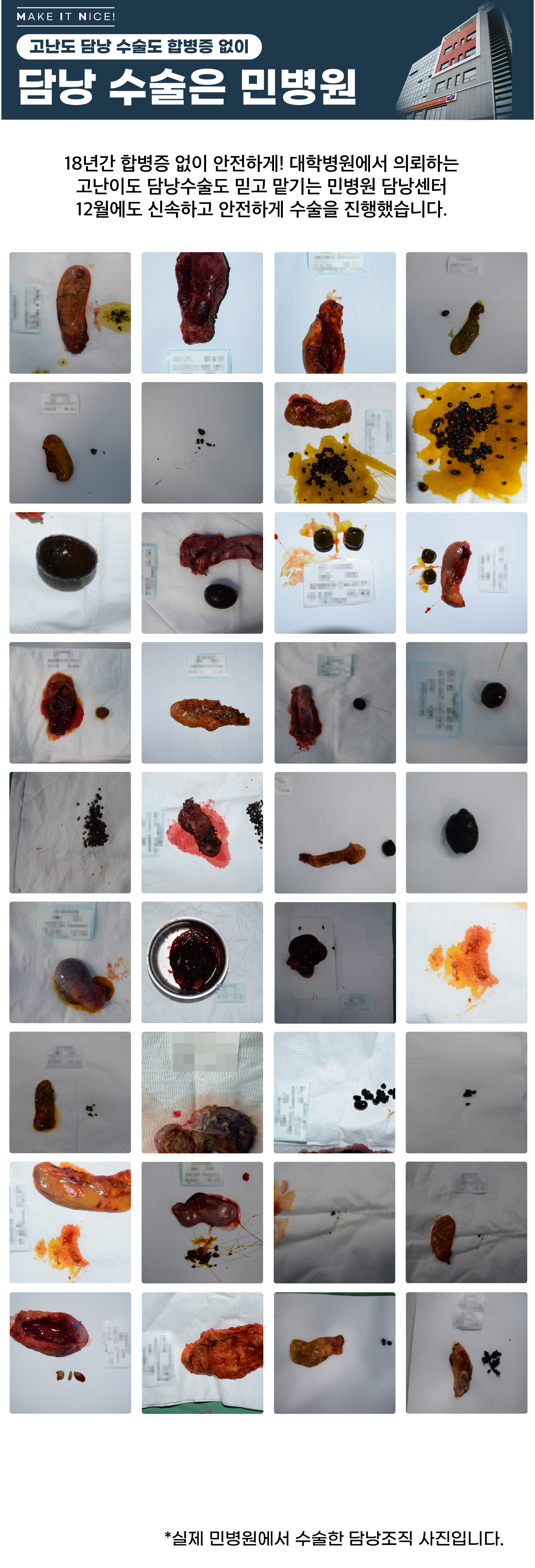 [담낭수술사례] 민병원 12월 담낭수술 후 제거된 조직 사진입니다...