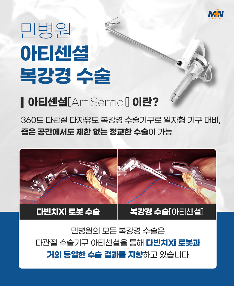 재발율을 낮춘 민병원 로봇 센터
