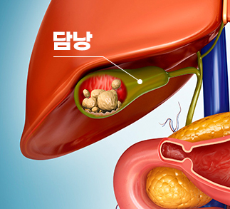 1형 당뇨병