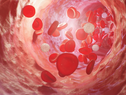 두경부 혈관 및 림프 조직 양성 병변