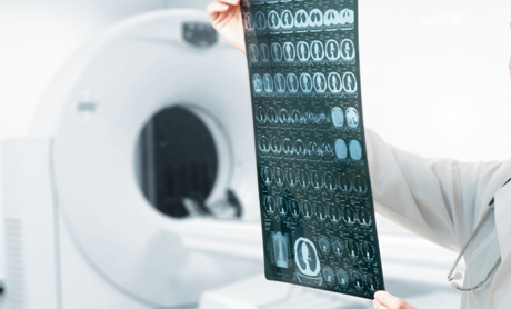 악성종양(암)의 치료